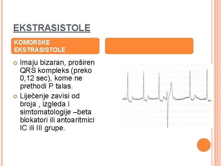 EKSTRASISTOLE KOMORSKE EKSTRASISTOLE Imaju bizaran, proširen QRS kompleks (preko 0, 12 sec), kome ne