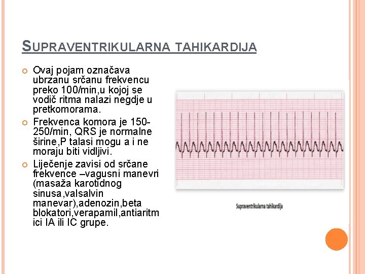 SUPRAVENTRIKULARNA TAHIKARDIJA Ovaj pojam označava ubrzanu srčanu frekvencu preko 100/min, u kojoj se vodič