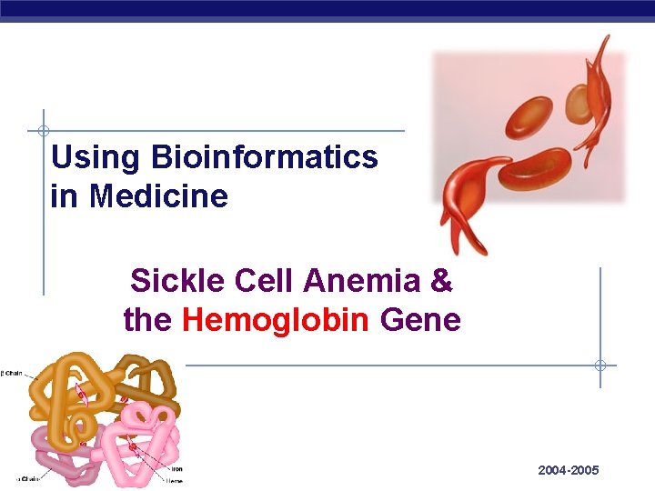 Using Bioinformatics in Medicine Sickle Cell Anemia & the Hemoglobin Gene AP Biology 2004