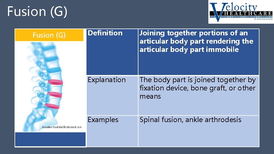 Fusion (G) Fusion G Definition Joining together portions of an articular body part rendering