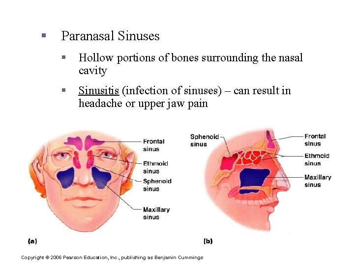 The Facial Bones § Paranasal Sinuses § Hollow portions of bones surrounding the nasal