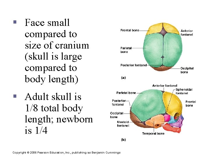 The Fetal Skull § Face small compared to size of cranium (skull is large