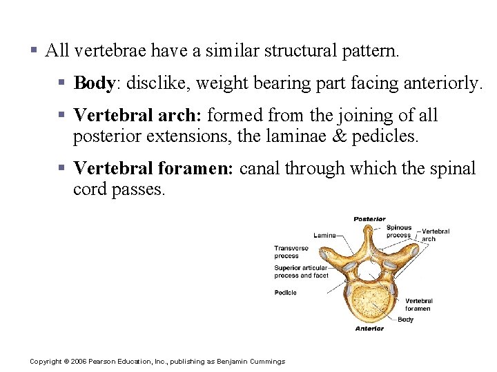 Vertebrae § All vertebrae have a similar structural pattern. § Body: disclike, weight bearing