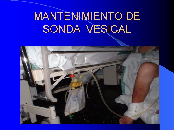 MANTENIMIENTO DE SONDA VESICAL 