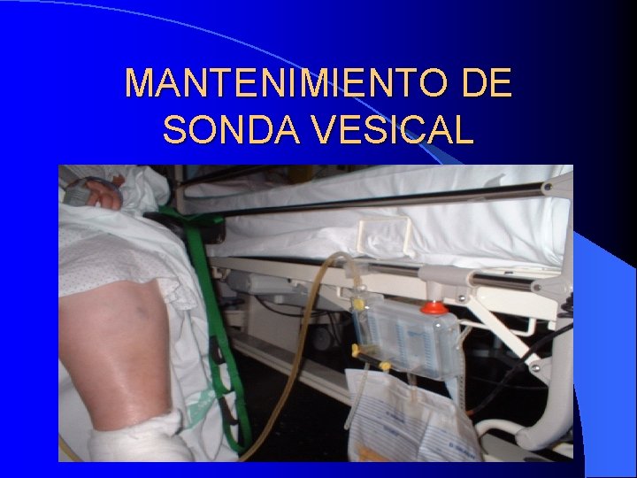 MANTENIMIENTO DE SONDA VESICAL 