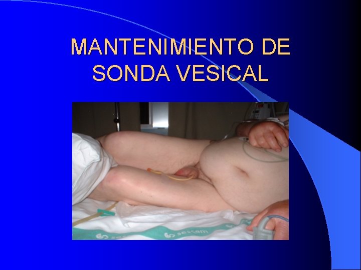 MANTENIMIENTO DE SONDA VESICAL 