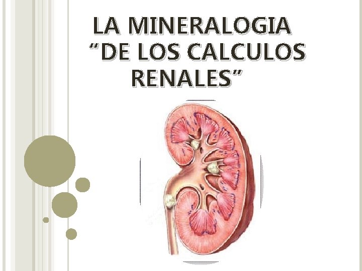 LA MINERALOGIA “DE LOS CALCULOS RENALES” 