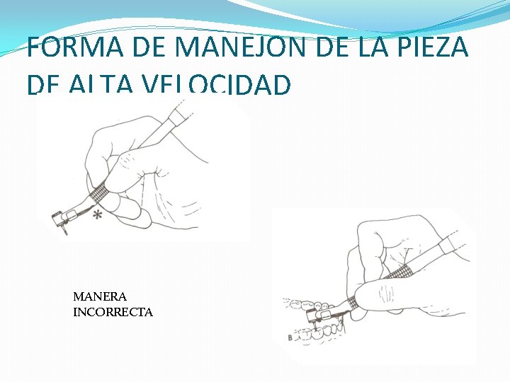 FORMA DE MANEJON DE LA PIEZA DE ALTA VELOCIDAD MANERA INCORRECTA FORMA DE MANEJON DE LA PIEZA DE ALTA VELOCIDAD MANERA INCORRECTA