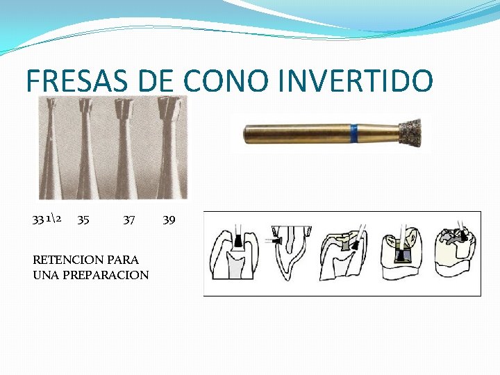 FRESAS DE CONO INVERTIDO 33 12 35 37 RETENCION PARA UNA PREPARACION 39 FRESAS DE CONO INVERTIDO 33 12 35 37 RETENCION PARA UNA PREPARACION 39