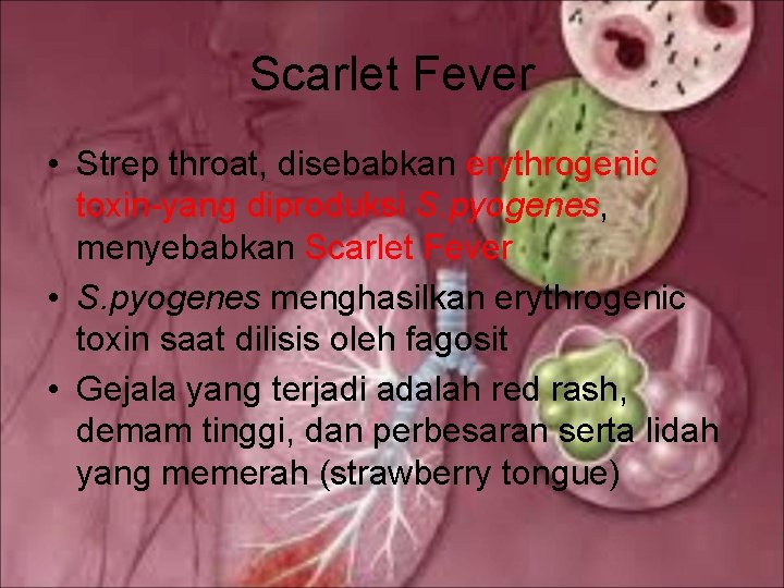 Scarlet Fever • Strep throat, disebabkan erythrogenic toxin-yang diproduksi S. pyogenes, menyebabkan Scarlet Fever