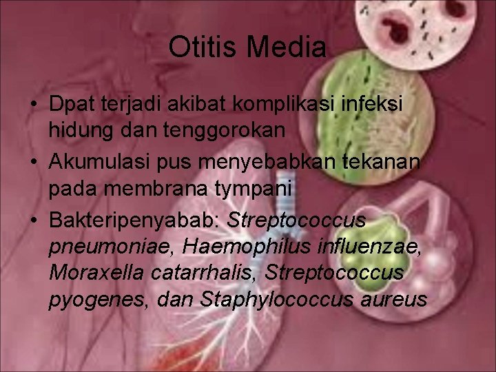 Otitis Media • Dpat terjadi akibat komplikasi infeksi hidung dan tenggorokan • Akumulasi pus