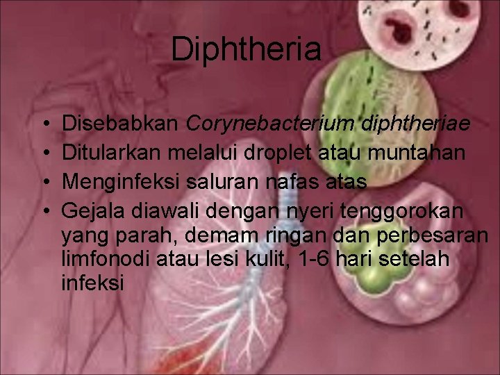 Diphtheria • • Disebabkan Corynebacterium diphtheriae Ditularkan melalui droplet atau muntahan Menginfeksi saluran nafas