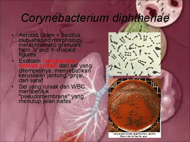 Corynebacterium diphtheriae • Aerobic Gram + bacillus, club-shaped morphology, metachromatic granules, form V and