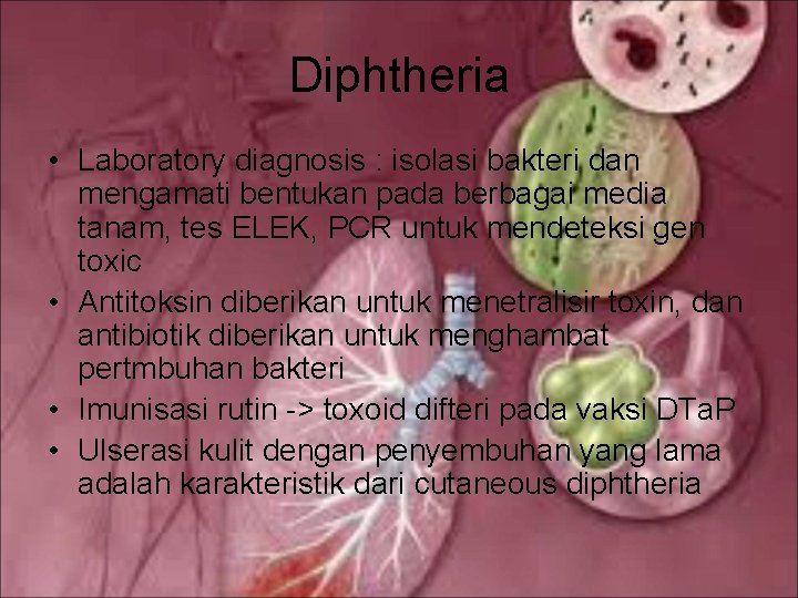 Diphtheria • Laboratory diagnosis : isolasi bakteri dan mengamati bentukan pada berbagai media tanam,