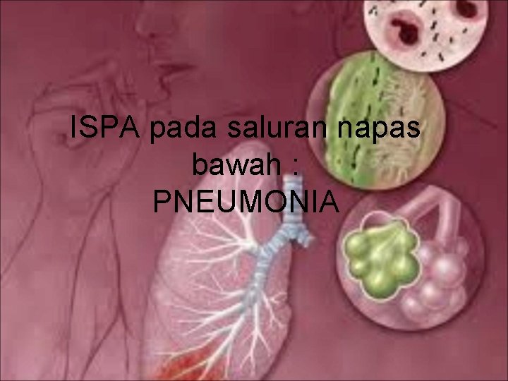 ISPA pada saluran napas bawah : PNEUMONIA 