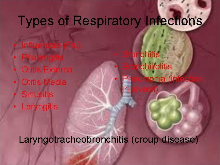 Types of Respiratory Infections • • • Influenzae (Flu) Pharyngitis Otitis Externa Otitis Media