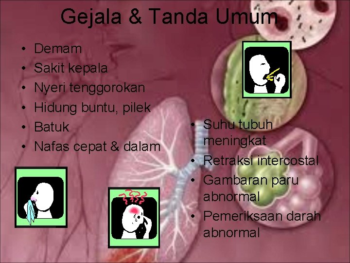 Gejala & Tanda Umum • • • Demam Sakit kepala Nyeri tenggorokan Hidung buntu,