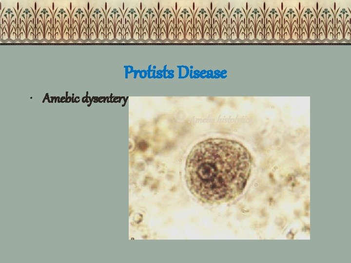 Protists Disease • Amebic dysentery Ameba histolytica 