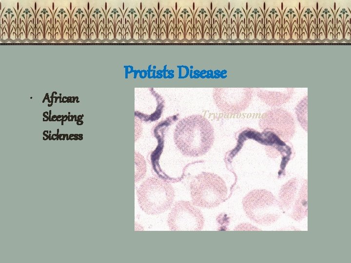 Protists Disease • African Sleeping Sickness Trypanosoma 