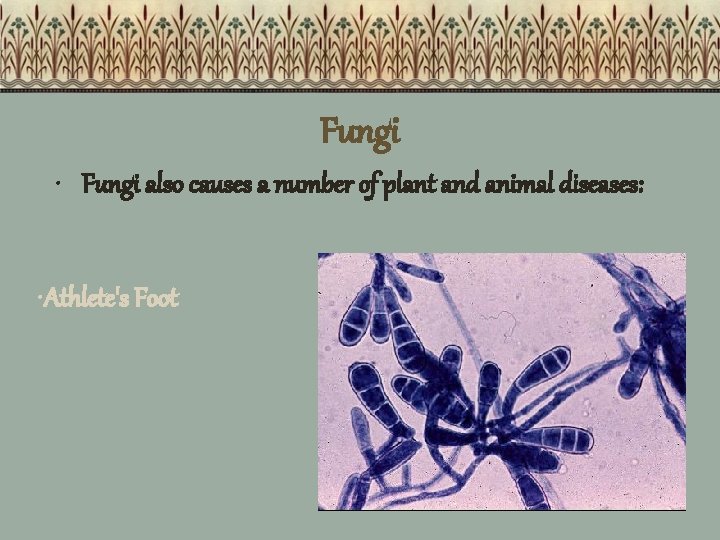 Fungi • Fungi also causes a number of plant and animal diseases: • Athlete's