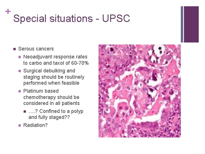 + Special situations - UPSC n Serous cancers n Neoadjuvant response rates to carbo