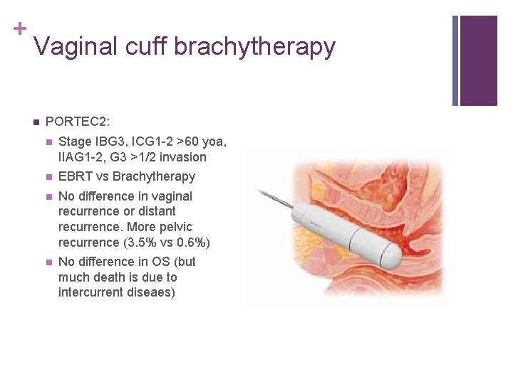 + Vaginal cuff brachytherapy n PORTEC 2: n Stage IBG 3, ICG 1 -2