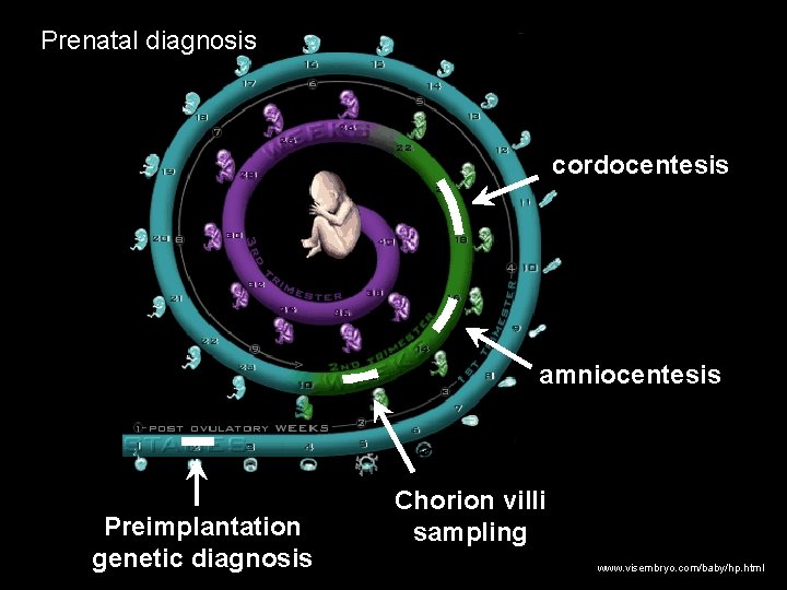 Prenatal diagnosis cordocentesis amniocentesis Preimplantation genetic diagnosis Chorion villi sampling www. visembryo. com/baby/hp. html Prenatal diagnosis cordocentesis amniocentesis Preimplantation genetic diagnosis Chorion villi sampling www. visembryo. com/baby/hp. html