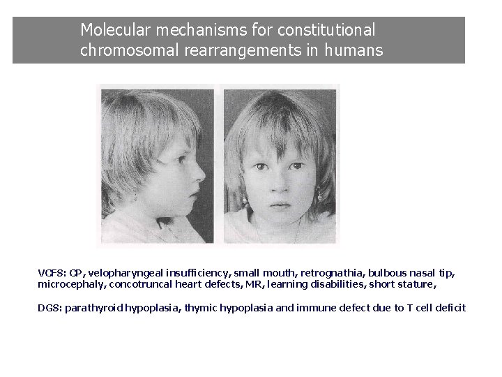 Molecular mechanisms for constitutional chromosomal rearrangements in humans VCFS: CP, velopharyngeal insufficiency, small mouth, Molecular mechanisms for constitutional chromosomal rearrangements in humans VCFS: CP, velopharyngeal insufficiency, small mouth,