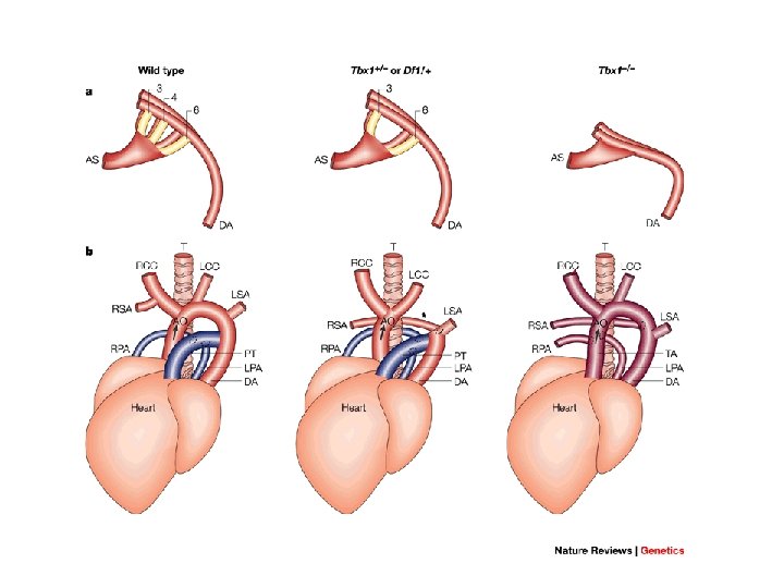 Molecular mechanisms for constitutional chromosomal rearrangements in humans Di. George syndrome velo-cardio-facial syndrome Molecular mechanisms for constitutional chromosomal rearrangements in humans Di. George syndrome velo-cardio-facial syndrome
