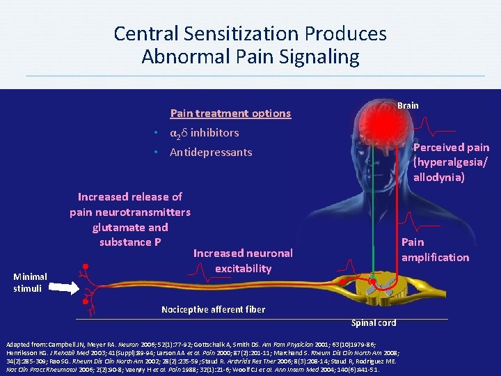 Central Sensitization Produces Abnormal Pain Signaling Brain Pain treatment options • α 2δ inhibitors