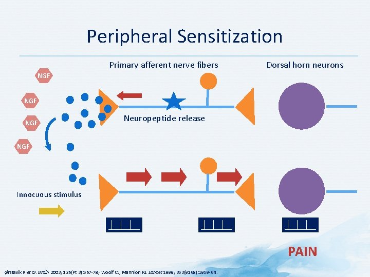 Peripheral Sensitization Primary afferent nerve fibers Dorsal horn neurons NGF NGF Neuropeptide release NGF