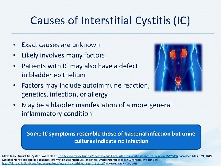 Causes of Interstitial Cystitis (IC) • Exact causes are unknown • Likely involves many