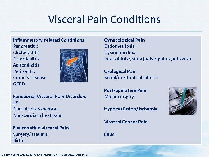 Visceral Pain Conditions Inflammatory-related Conditions Pancreatitis Cholecystitis Diverticulitis Appendicitis Peritonitis Crohn’s Disease GERD Functional