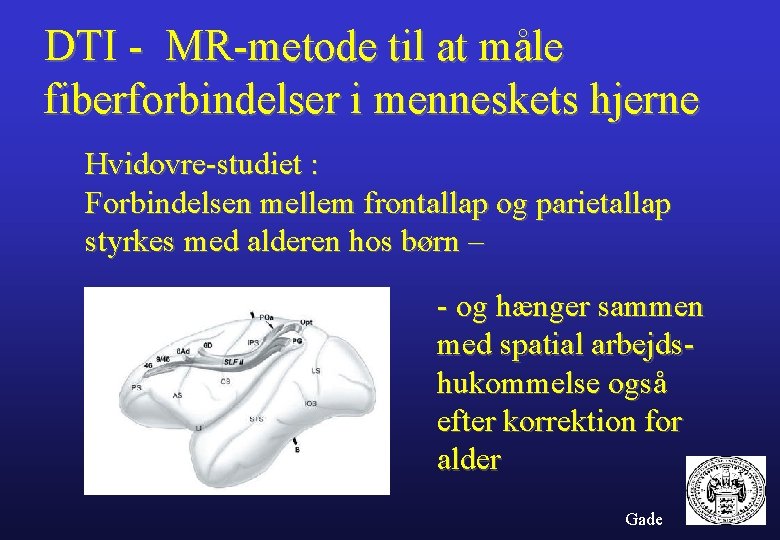 DTI - MR-metode til at måle fiberforbindelser i menneskets hjerne Hvidovre-studiet : Forbindelsen mellem