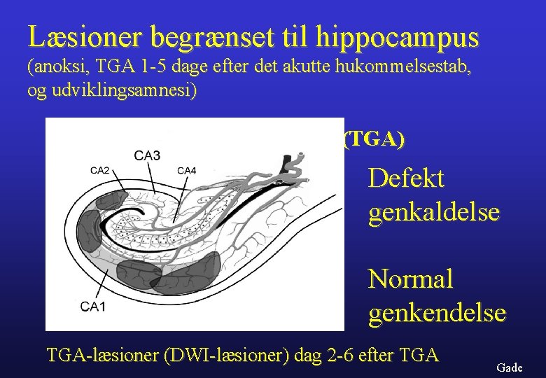 Læsioner begrænset til hippocampus (anoksi, TGA 1 -5 dage efter det akutte hukommelsestab, og