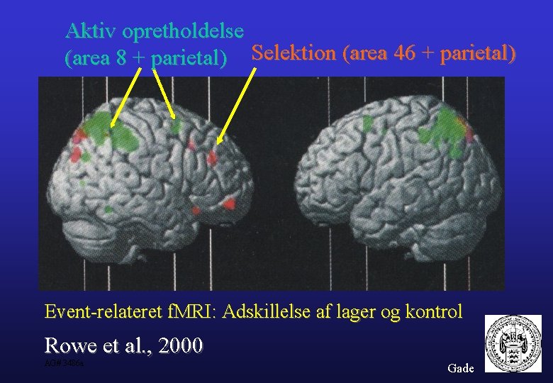 Aktiv opretholdelse (area 8 + parietal) Selektion (area 46 + parietal) Event-relateret f. MRI:
