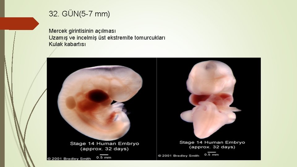 32. GÜN(5 -7 mm) Mercek girintisinin açılması Uzamış ve incelmiş üst ekstremite tomurcukları Kulak