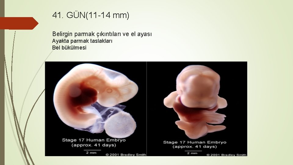 41. GÜN(11 -14 mm) Belirgin parmak çıkıntıları ve el ayası Ayakta parmak taslakları Bel