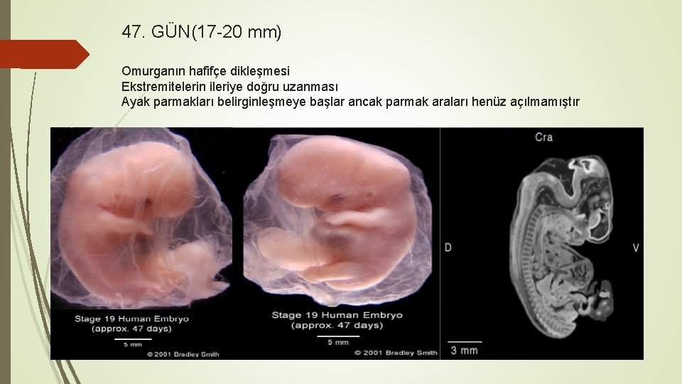 47. GÜN(17 -20 mm) Omurganın hafifçe dikleşmesi Ekstremitelerin ileriye doğru uzanması Ayak parmakları belirginleşmeye