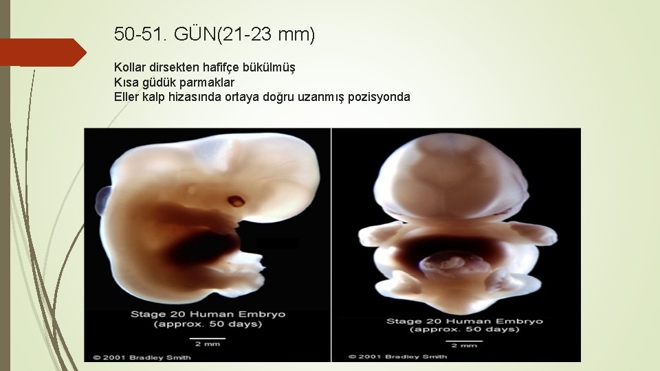 50 -51. GÜN(21 -23 mm) Kollar dirsekten hafifçe bükülmüş Kısa güdük parmaklar Eller kalp