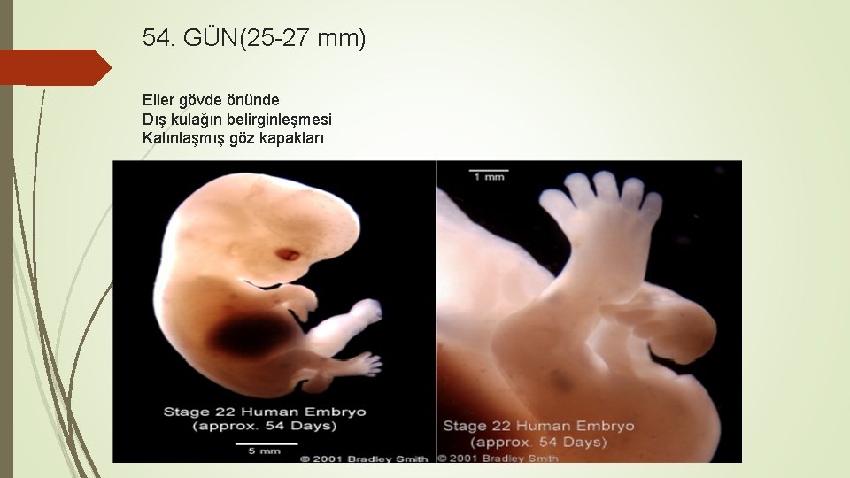 54. GÜN(25 -27 mm) Eller gövde önünde Dış kulağın belirginleşmesi Kalınlaşmış göz kapakları 