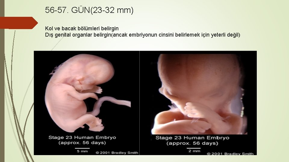 56 -57. GÜN(23 -32 mm) Kol ve bacak bölümleri belirgin Dış genital organlar belirgin(ancak