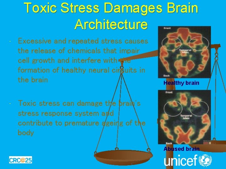 Toxic Stress Damages Brain Architecture • • Excessive and repeated stress causes the release