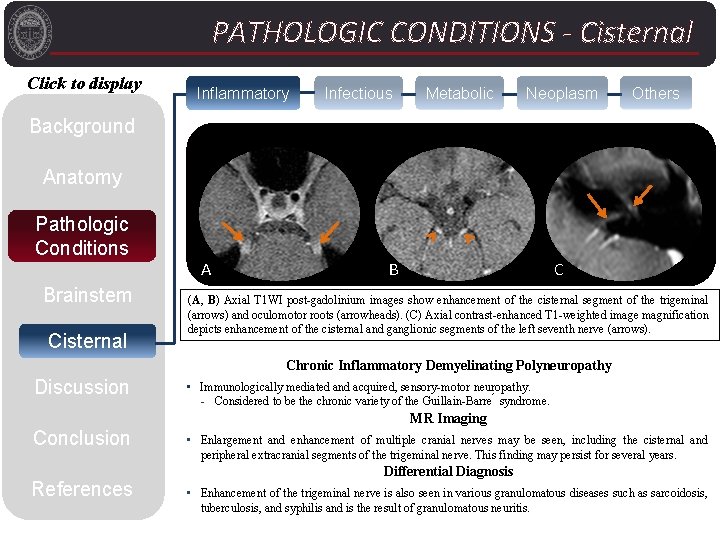 PATHOLOGIC CONDITIONS - Cisternal Click to display Inflammatory Infectious Metabolic Neoplasm Others Background Anatomy