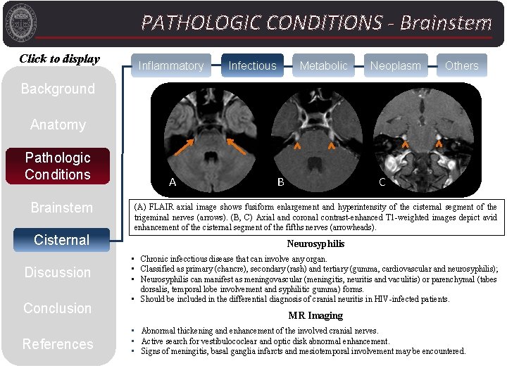 PATHOLOGIC CONDITIONS - Brainstem Click to display Inflammatory Infectious Metabolic Neoplasm Others Background Anatomy
