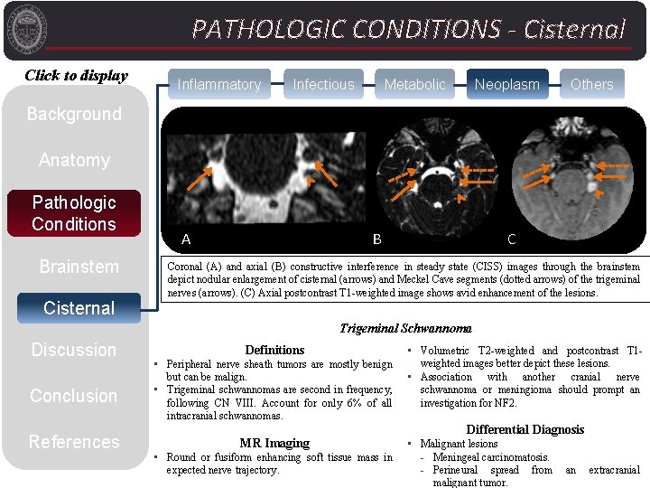 PATHOLOGIC CONDITIONS - Cisternal Click to display Inflammatory Infectious Metabolic Neoplasm Others Background C