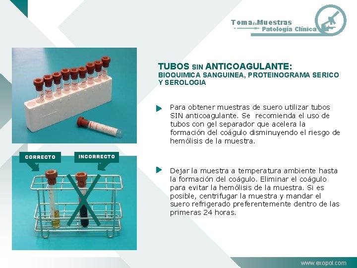 Tomade. Muestras Patología Clínica TUBOS SIN ANTICOAGULANTE: BIOQUIMICA SANGUINEA, PROTEINOGRAMA SERICO Y SEROLOGIA Para