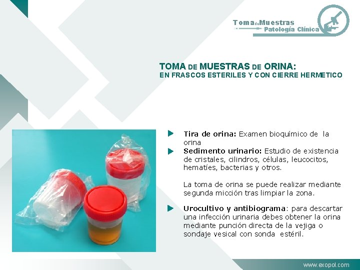 Tomade. Muestras Patología Clínica TOMA DE MUESTRAS DE ORINA: EN FRASCOS ESTERILES Y CON