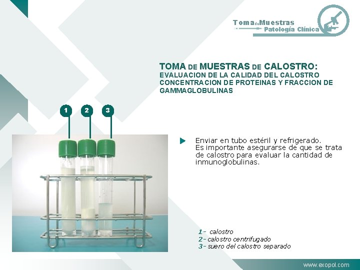 Tomade. Muestras Patología Clínica TOMA DE MUESTRAS DE CALOSTRO: EVALUACION DE LA CALIDAD DEL