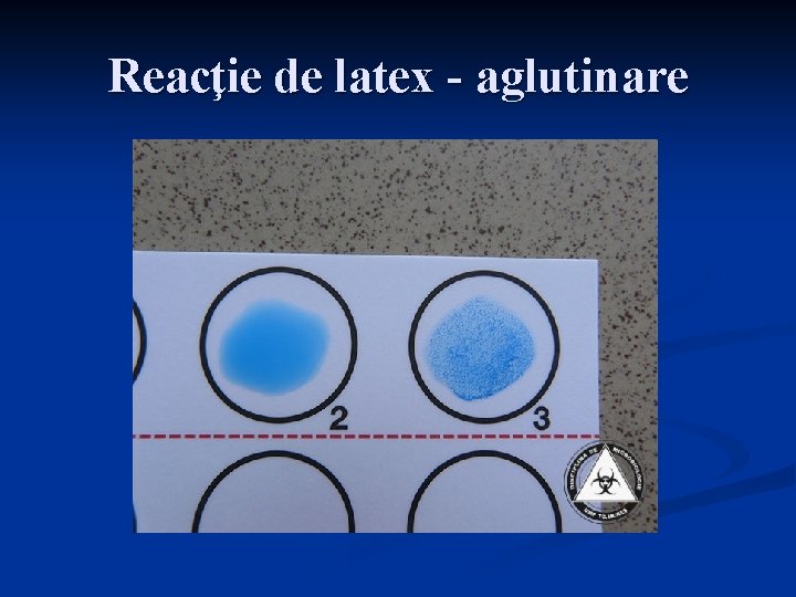 Reacţie de latex - aglutinare 